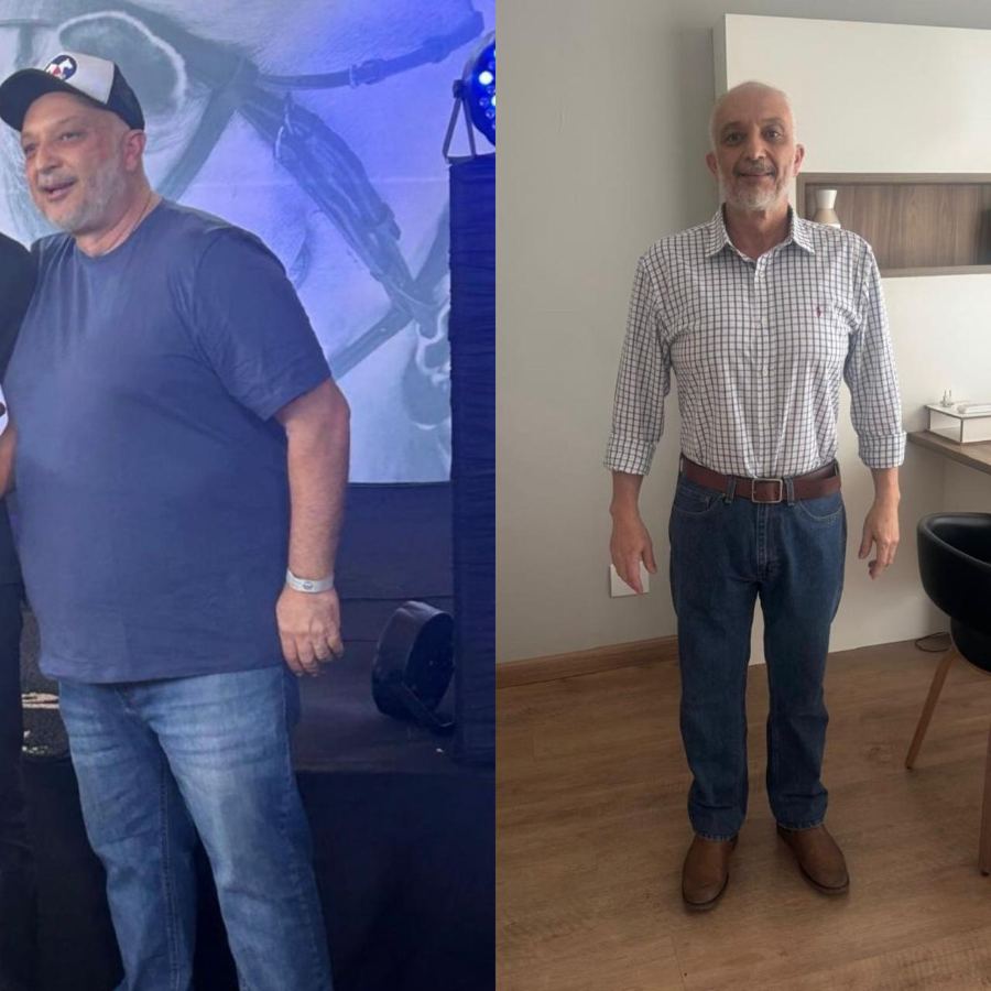Transformação Edésio — antes e depois