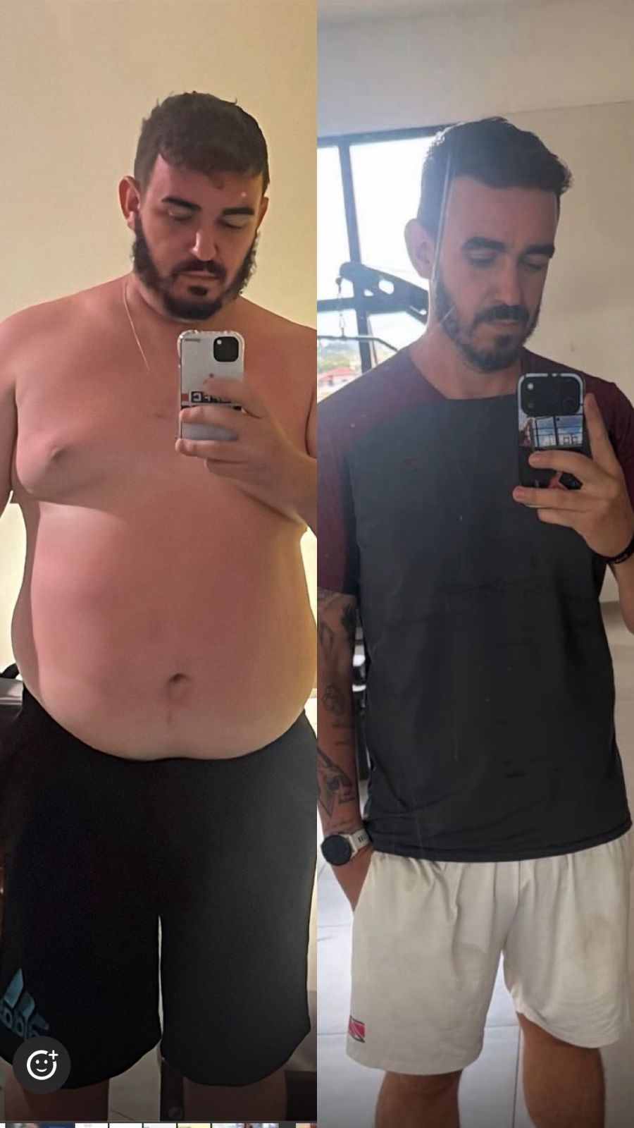 Transformação Luís Gustavo — antes e depois